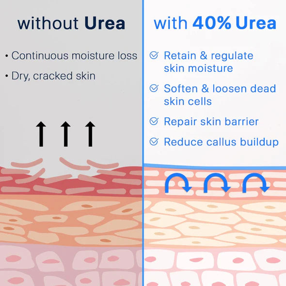 Ebanel Urea 40% Cream 130g يوريا بتركيز 40% للجسم والقدم