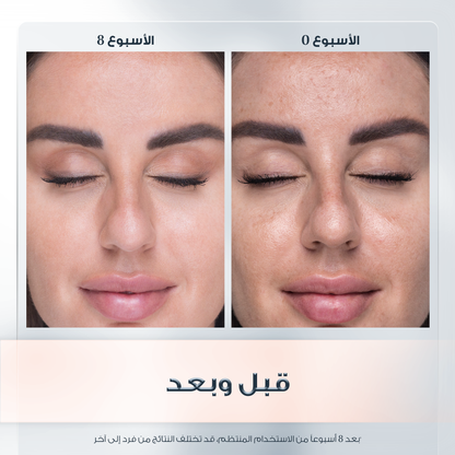 Eucerin Even Pigment Perfector Spf30 Day Cream 50ml كريم نهاري المضاد للتصبغات